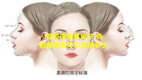 骨胶原隆鼻牌子 骨胶原隆鼻可以维持多久